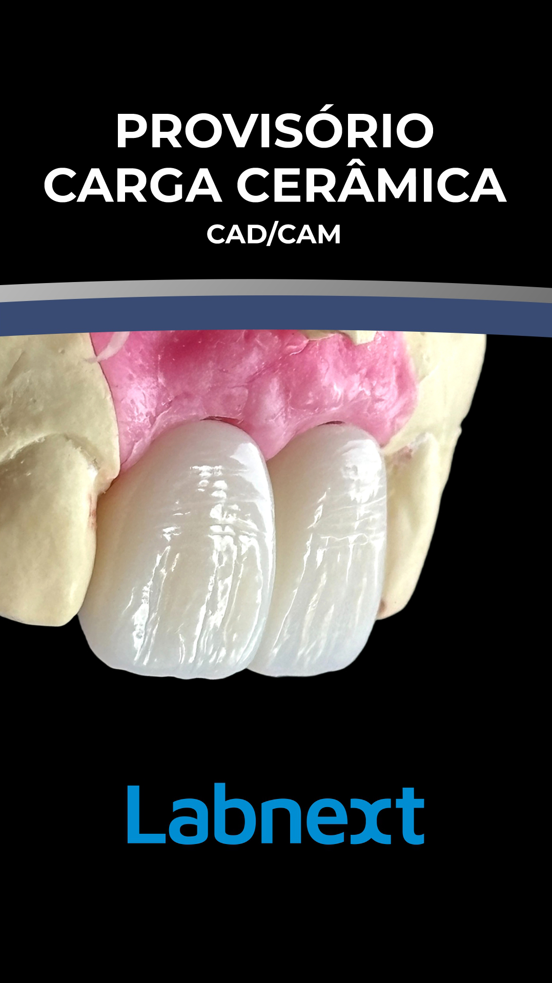 odontonight carga ceramica