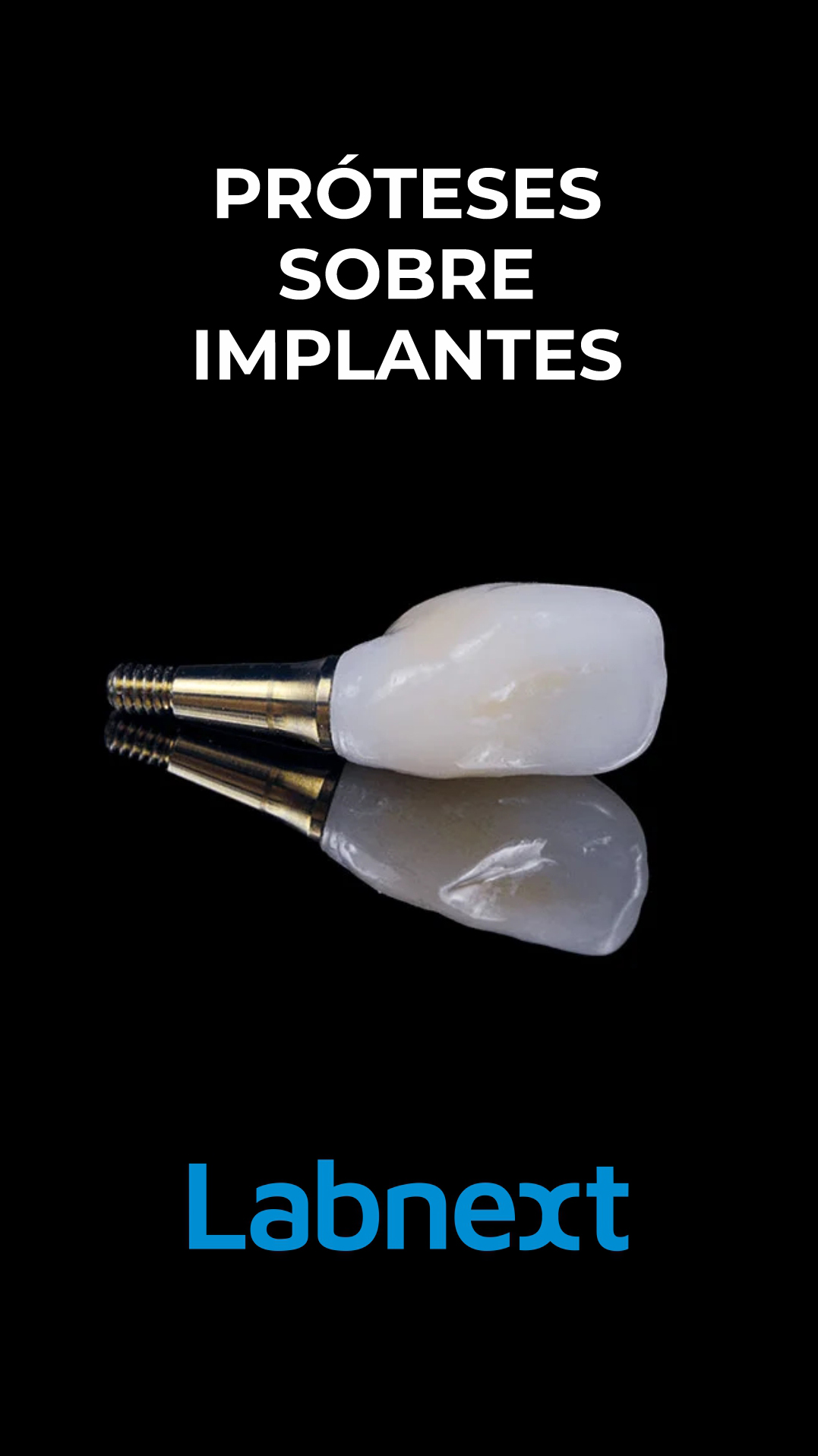odontonight protese sobre implante