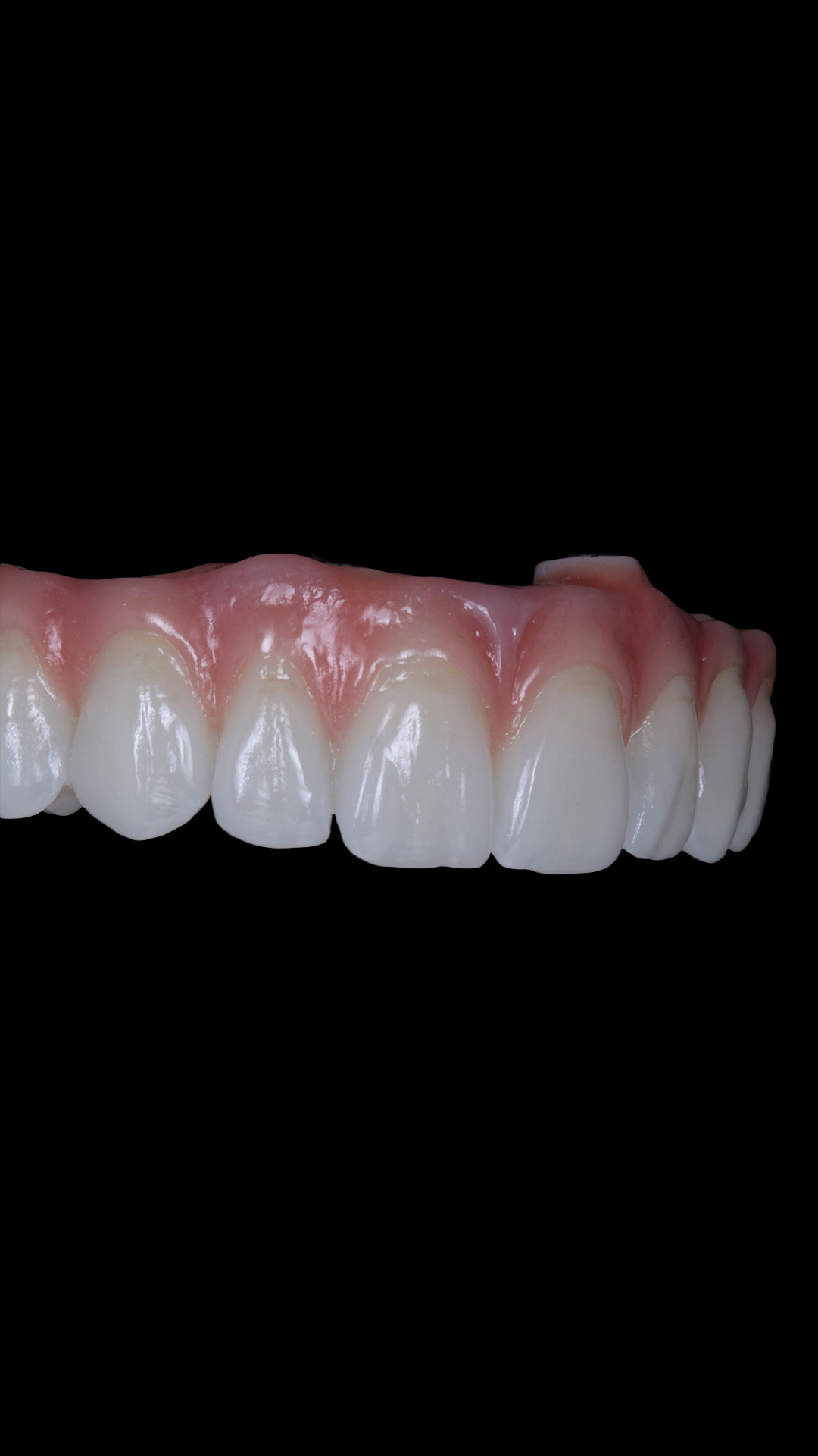 protocolo zirconia 3