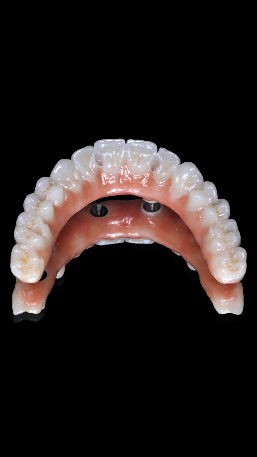 protocolo zirconia 4