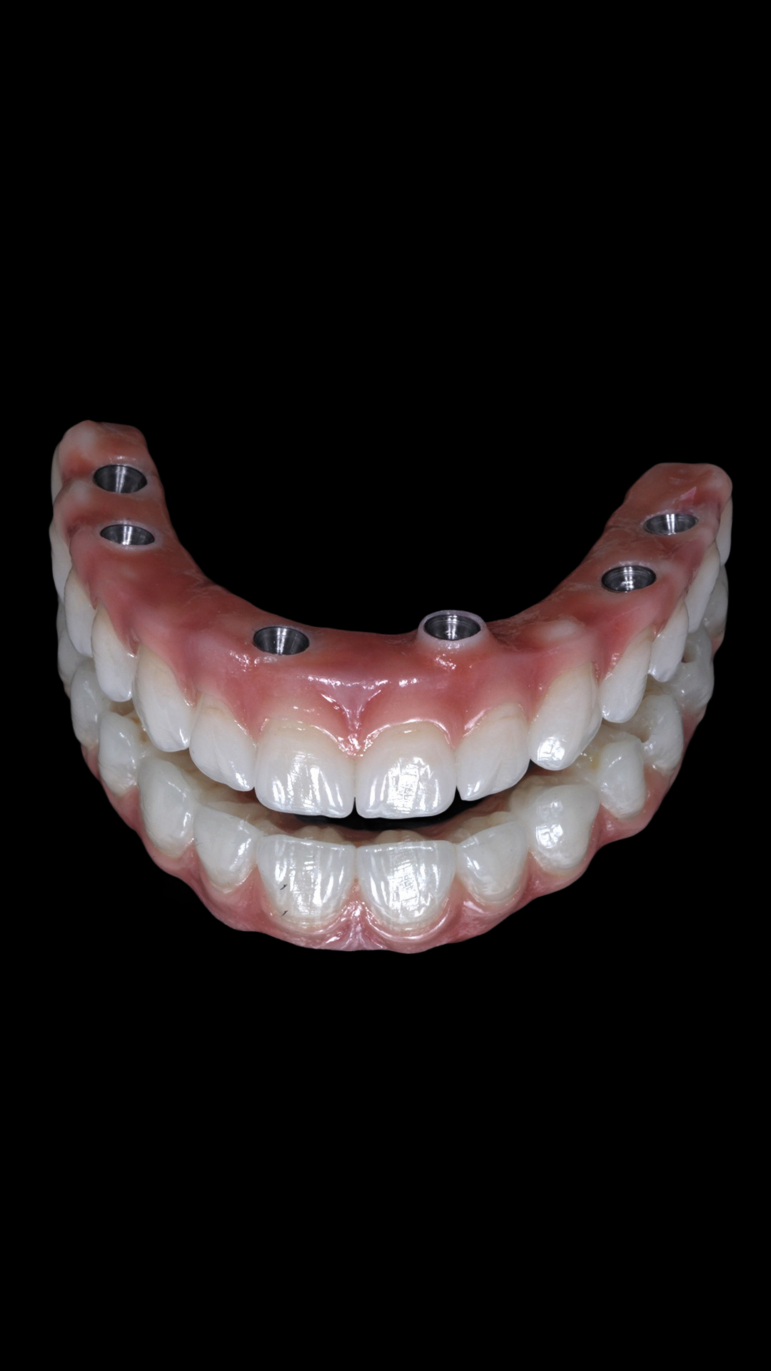 protocolo zirconia 5
