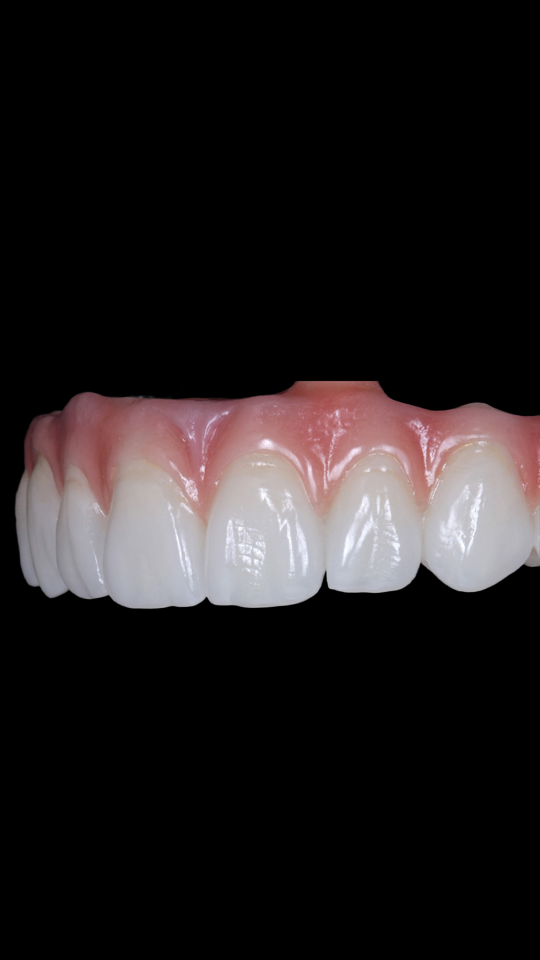 protocolo zirconia 8